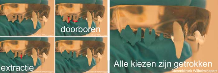 We trekken de kiezen van de bovenkaak op een vaste manier